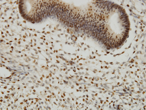 IHC - YY1 Antibody (monoclonal) (M03) AT4564a
